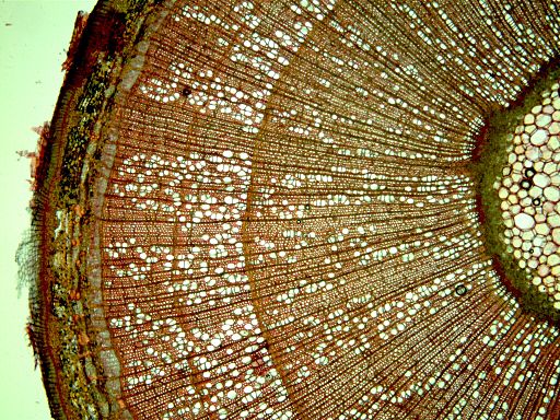 Tree-ring anatomy